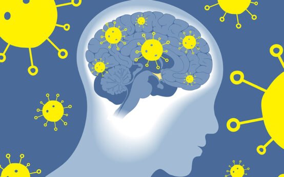 Brain Fog The New Long COVID Symptom