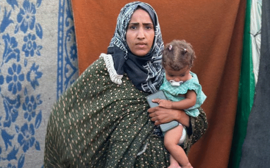 UN Reports Sharp Rise in Child Malnutrition Rates in Gaza